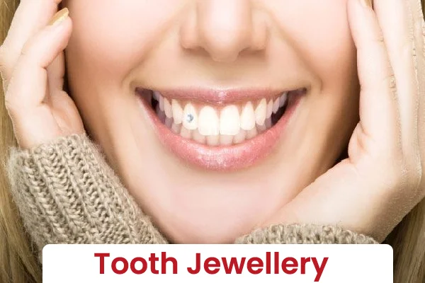 Tooth Jewellery