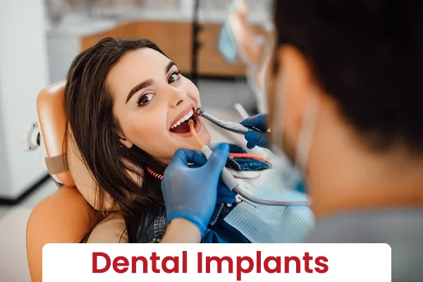 Dental Implants