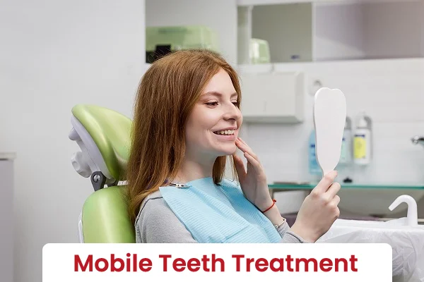 Mobile Teeth Treatment