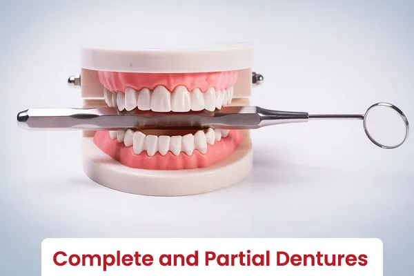 Complete and Partial Dentures